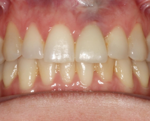 Case of the month image 6