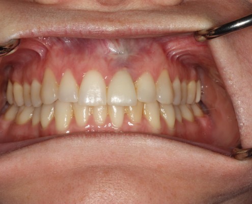 Case of the month image 1