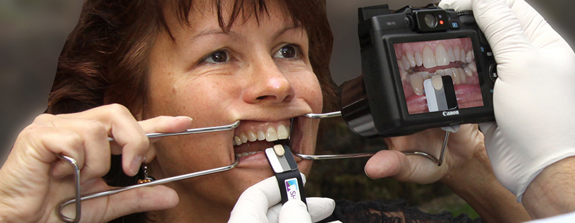 5 Ways Dental Photography Can Make Money for Your Dental Practice