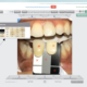 ShadeWave Announces Issuance of US Patent for Dental Shade Map Matching Technology