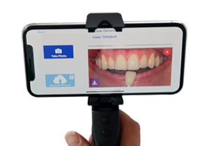 Using iPhones for Dental Photography